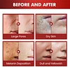 dragon blood cream